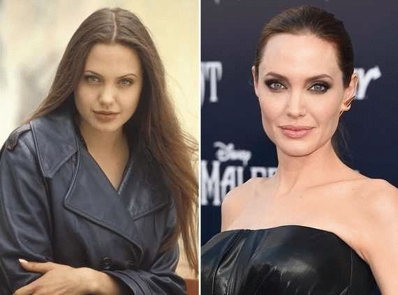 Фото Анджелины Джоли до и после операций: сравнение
