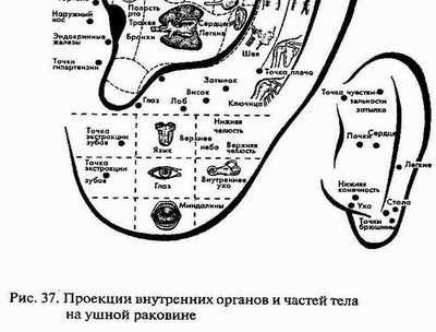 Преимущества и недостатки каждого способа