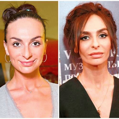 Изменения во внешности: перед и после операций