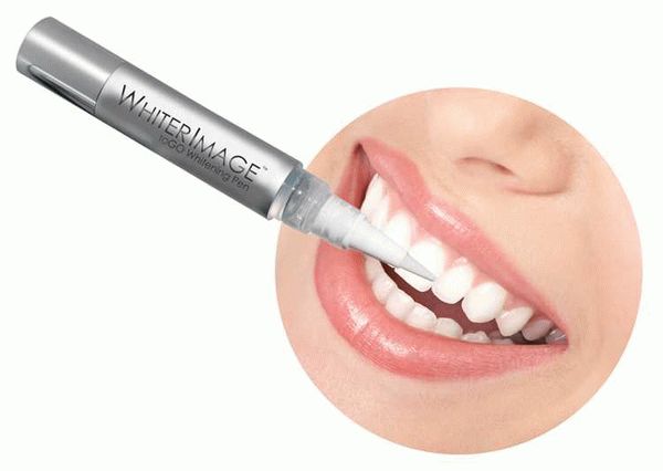 Opalescence PF гель - эффективное средство для отбеливания зубов