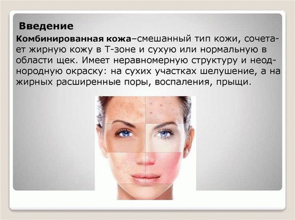 Основные типы кожи лица